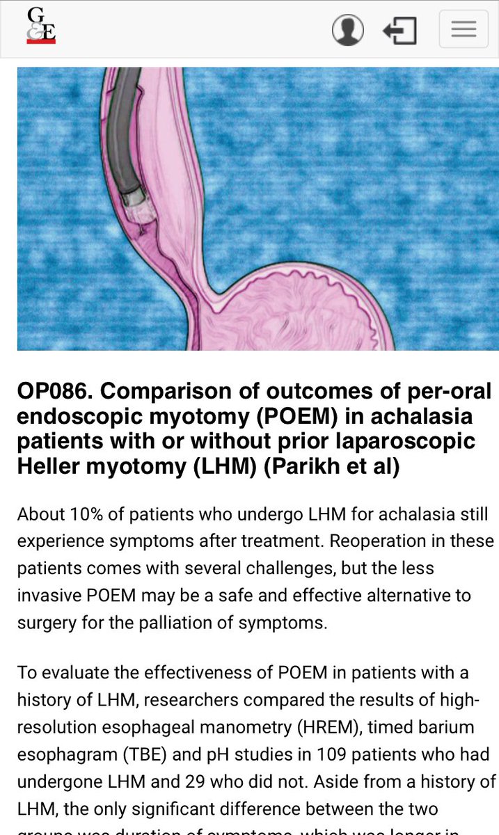 Malav Parikh MD, FACP (@malavparikh88) on Twitter photo Our POEM research presented at UEG week, Austria 🇦🇹 is highlighted in Gastroenterology & Endoscopy news!!
Thanks to my outstanding mentors Dr.Sanaka and Dr.Raja
<a href="/MadhuSanakaMD/">Madhu Sanaka</a> <a href="/ScottGabbardMD/">Scott Gabbard</a> <a href="/MRegueiroMD/">Miguel Regueiro</a> <a href="/drniyatigupta/">Niyati Gupta</a> <a href="/CleClinicMD/">Cleveland Clinic MD</a> <a href="/gastroendonews/">Gastroenterology & Endoscopy News</a>
gastroendonews.com/In-the-News/Ar… Our POEM research presented at UEG week, Austria 🇦🇹 is highlighted in Gastroenterology & Endoscopy news!!
Thanks to my outstanding mentors Dr.Sanaka and Dr.Raja
<a href="/MadhuSanakaMD/">Madhu Sanaka</a> <a href="/ScottGabbardMD/">Scott Gabbard</a> <a href="/MRegueiroMD/">Miguel Regueiro</a> <a href="/drniyatigupta/">Niyati Gupta</a> <a href="/CleClinicMD/">Cleveland Clinic MD</a> <a href="/gastroendonews/">Gastroenterology & Endoscopy News</a>
gastroendonews.com/In-the-News/Ar…