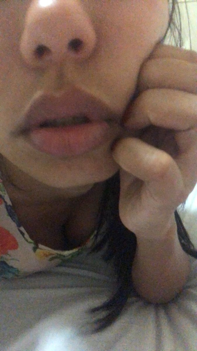 PriXimango's tweet image. Amando meu bocão ❤️😍 #preenchimentolabial 👄