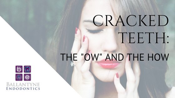 BallantyneEndo's tweet image. Unfortunately, #CrackedTeeth aren't completely preventable. However, you can take some steps to make your teeth less susceptible to cracks &amp;gt;&amp;gt; ow.ly/F5nU30nkcUd