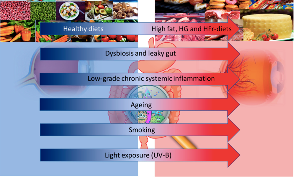 OculistItaliano's tweet image. Diverse evidenze cliniche attestano che per la forma atrofica della #DMLE il controllo nutrizionale costituisce la migliore strategia di prevenzione. 
Che ruolo ricopre, invece, il #microbioma intestinale?

#benessere #food #occhi 
oculistaitaliano.it/articoli/micro…