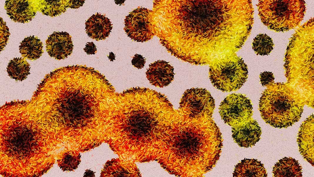 MicrobesInfect's tweet image. This #AI Can Tell Your Age by Analyzing Your Gut #microbiome

It predicts age to within 4 years based on the gut #microbiota data. Results also suggest that 39 microbial species are important in relation to accurately predicting age.

singularityhub.com/2019/02/05/thi… #DeepLearning