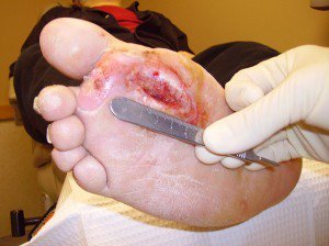 neuropadtest's tweet photo. .@DiabetesUK .@ChrisAskewCE If you truly want to help people with diabetes avoid foot ulcers and amputations, as you regularly state, you should lobby @NICEcomms to get @neuropadtest guidance corrected and get NG19 updated to include it. How else can HCPs risk stratify patients? https://t.co/Z0C7vVhKxN
