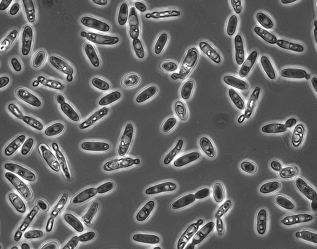 bhftechnologies's tweet image. #Brettanomyces giving you trouble? Try this.

bhftechnologies.com.au/stop-brettanom…