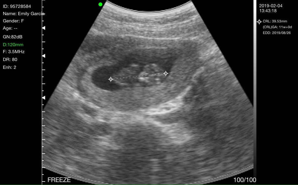 profeluis__'s tweet image. #Pichirilo
Lunes 4| Feb|2019 
¡Primer Encuentro!❤️