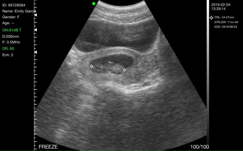 profeluis__'s tweet image. #Pichirilo
Lunes 4| Feb|2019 
¡Primer Encuentro!❤️