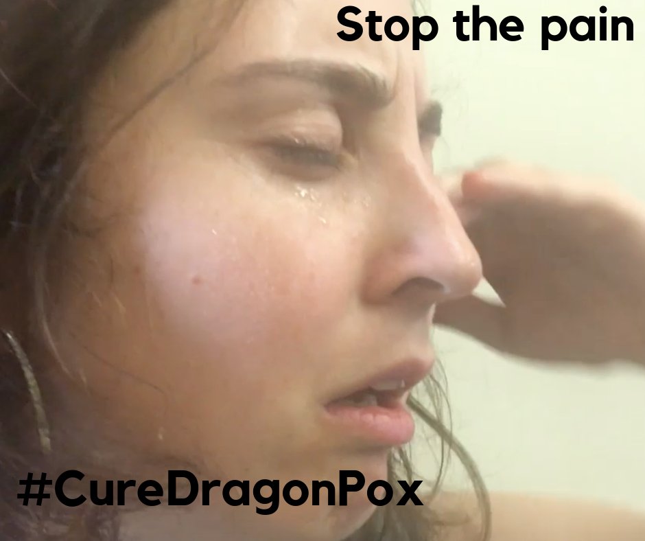 HealthMagical's tweet image. Emma has been crying continuously for 15 whole days because her entire life has been turned upside down by dragonpox. Please send us your dragonpox story so that we can present it to council so we can construct the Pottermore Magical Health Research Centre #CureDragonPox #OUDI19