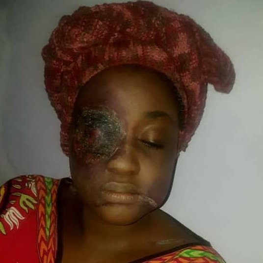 bih_takwe's tweet photo. Goodmorning Fam, @red.esthetics is the full package for all your movies!! Hire us😊😊
#specialeffectsmakeup #specialeffects #sfxmakeup #sfxmakeuptutorial #goremakeup #237Community #REDmanagement #raisingestheticdomain #REDStudios #RaisingEstheticDomain https://t.co/SigbFzJt7G