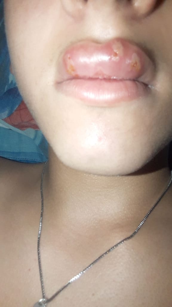 RT o mañana despertas asi