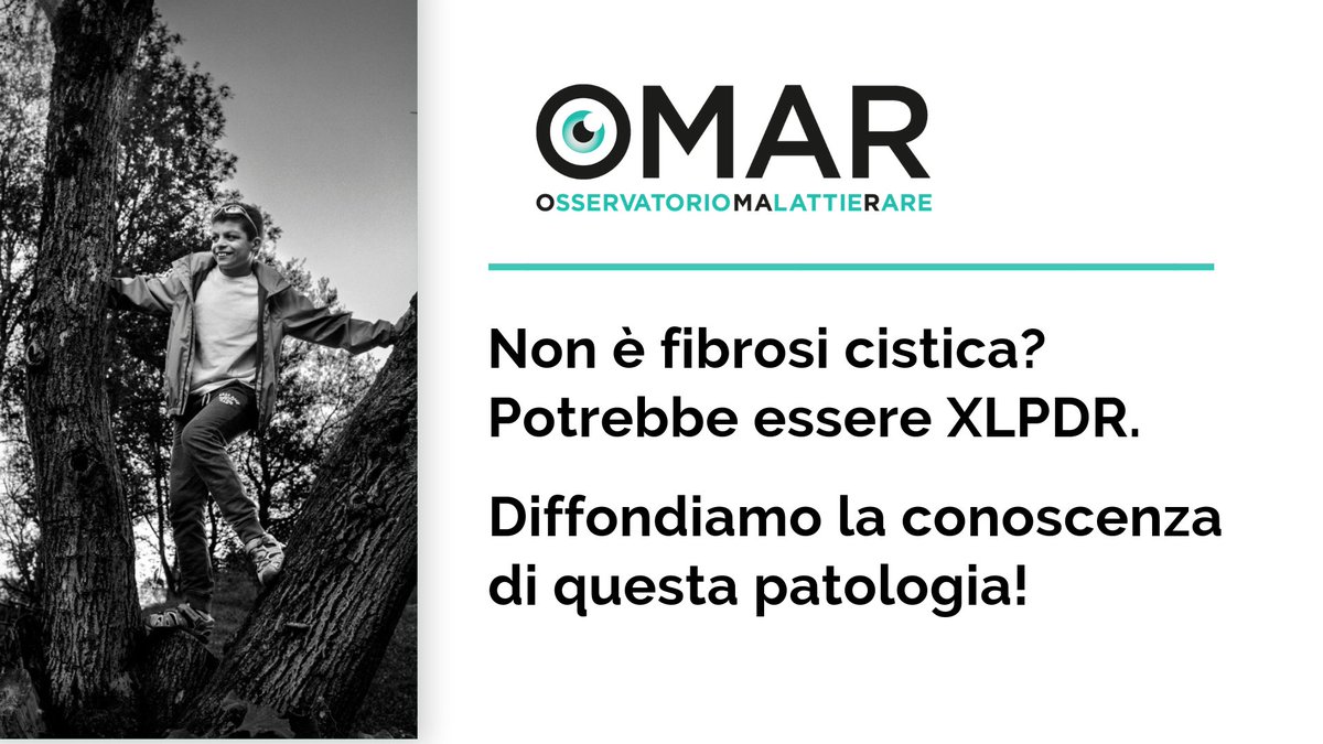 OssMalattieRare's tweet photo. Una sindrome rarissima con soli 21 casi al mondo. L'unico italiano è l'undicenne Alex.
#XLPDR, disturbo reticolare della pigmentazione legato all'X.
📢 Aiutaci a diffondere la conoscenza di questa patologia, spesso diagnosticata come #FibrosiCistica.
👉 https://t.co/mjAL5rExJg https://t.co/jwWjXF3J6B