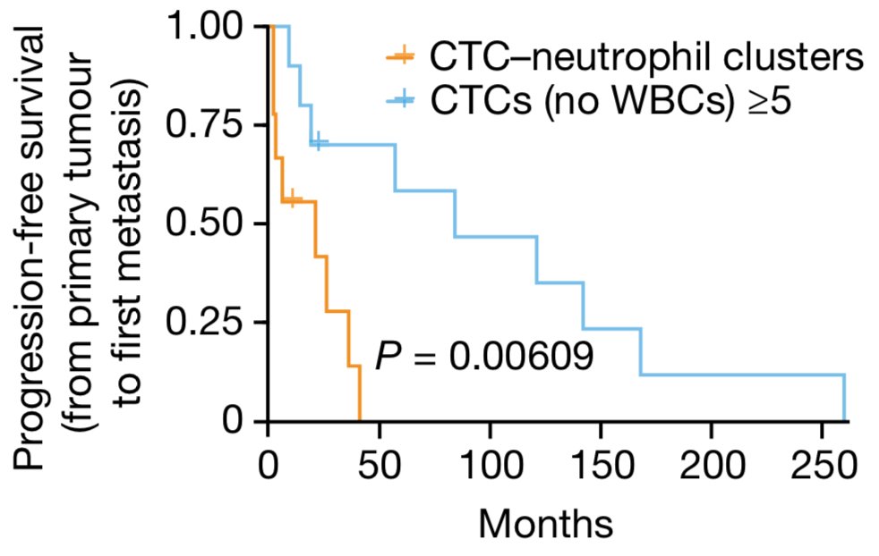 PittetLab's tweet photo. More evidence that #neutrophils can promote #cancer progression. This study reports that #neutrophils can attach to circulating tumor cells and when this happens the tumor cells become more likely to produce metastases. 
https://t.co/MvdVsDKo2u https://t.co/hrxZGgzqaM