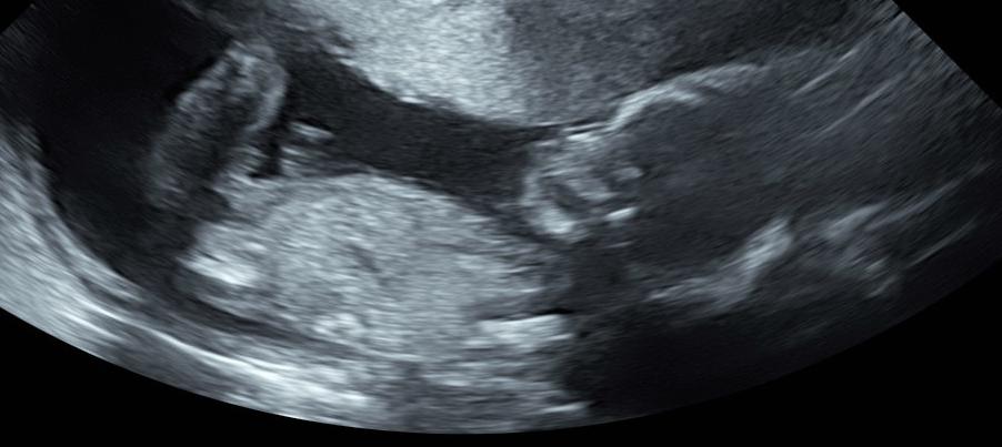 Daddy_Steps's tweet image. I will be a dad in 18 weeks. Read my first Blog entry documenting our journey to finding out what our baby's gender is and the steps I am taking before I become a daddy. #FirstTimeDad #pregnancy #DaddySteps #GenderReview #love 

Check it out here: bit.ly/DaddySteps