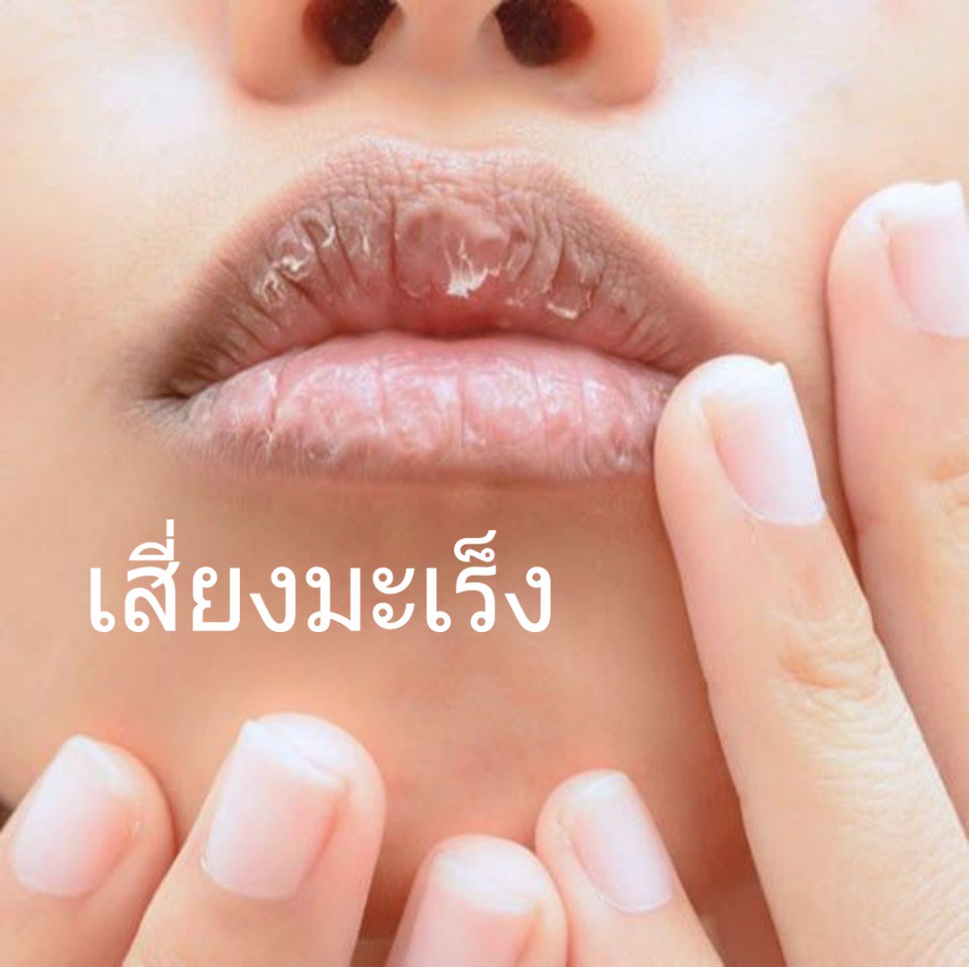 KCHARITHAILAND's tweet photo. พาราเบน.  ยิ่งใช้ ยิ่งสะสม ทำให้ระคายเคือง และอาจก่อมะเร็งได้ด้วยนะคะ https://t.co/jOUUAchTSA