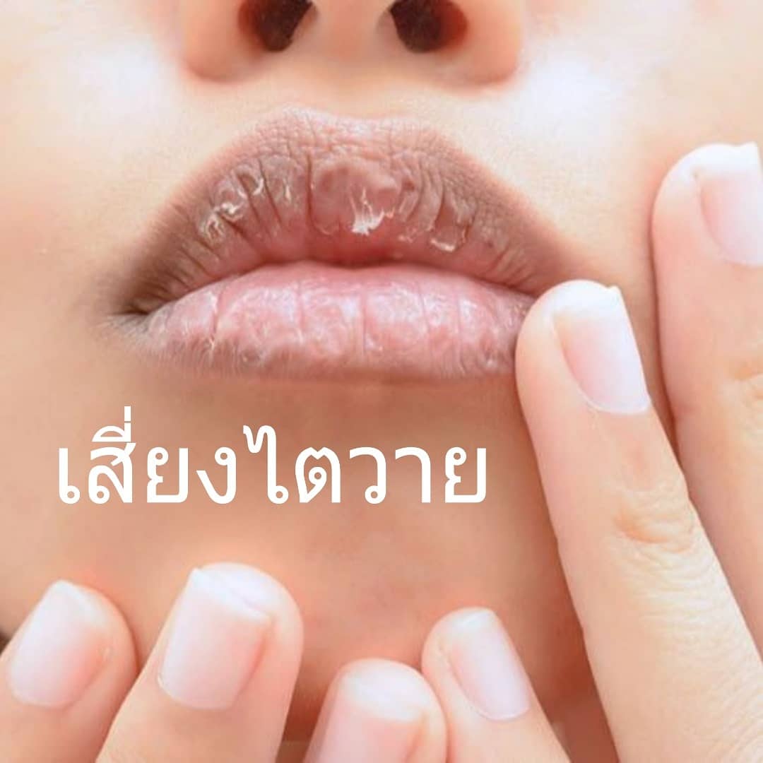 KCHARITHAILAND's tweet photo. เสี่ยงไต จากลิป โดยเฉพาะ ลิป Copy brand  และลิปปลอม เพราะอาจมี " แคดเมียม ทร่เป็นสารโลหะหนัก" ถ้าสะสมในร่างกายมากๆ ไตจะทำงานหนักเพราะขับออกไปได้ยากมากค่ะ https://t.co/kWtXbrc0uH