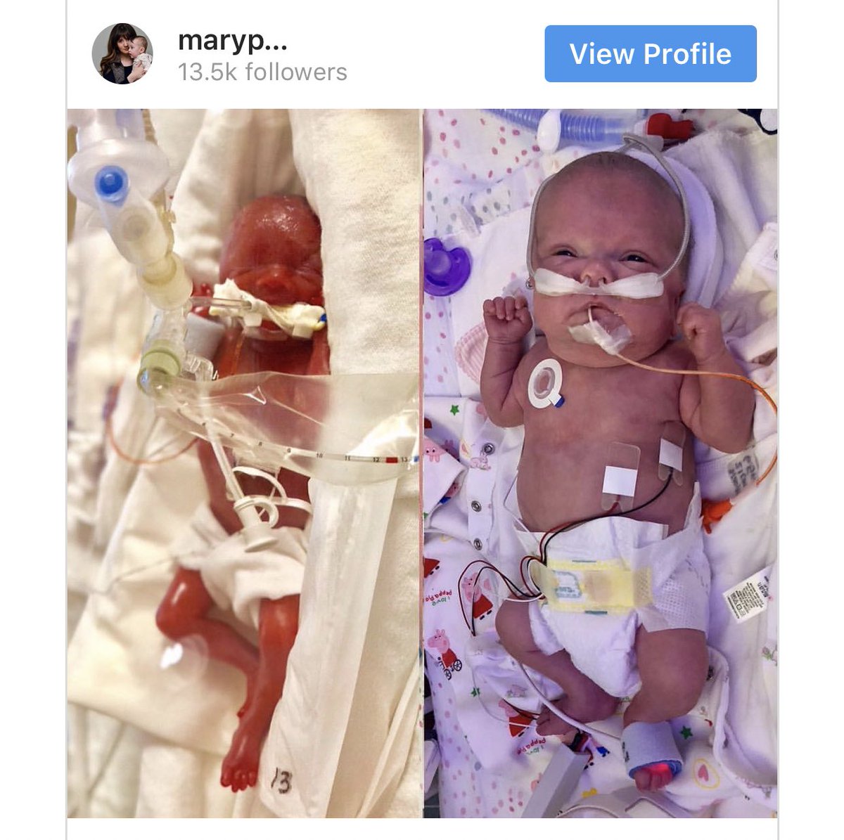 Baby Grace was born at 23 weeks and weighed 1 pound.  https://www.independent.co.uk/life-style/health-and-families/baby-premature-transformation-23-weeks-pregnant-mary-parkins-grace-a8289096.html