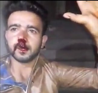 Fahad Shah (@pzfahad) on Twitter photo Kashmiri shawl trader Javid Ahmad Khan, 27, mercilessly beaten up by an abusive mob in Taherpur area of Nadia district in West Bengal last night. Mob was forcing him to chant ‘Vande Mataram’ while abusing him. <a href="/MamataOfficial/">Mamata Banerjee</a> #kashmir Kashmiri shawl trader Javid Ahmad Khan, 27, mercilessly beaten up by an abusive mob in Taherpur area of Nadia district in West Bengal last night. Mob was forcing him to chant ‘Vande Mataram’ while abusing him. <a href="/MamataOfficial/">Mamata Banerjee</a> #kashmir