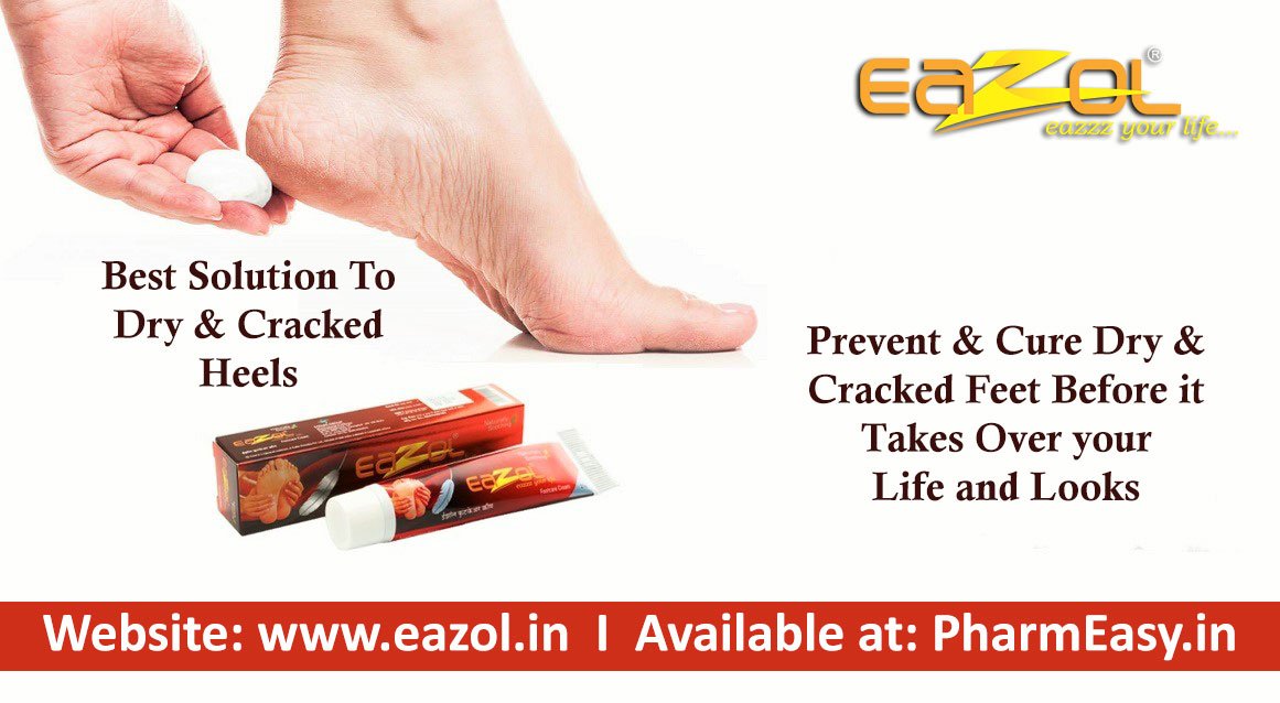 Ayurveda Treatment for Cracked Heels | Ayurclinic Melbourne