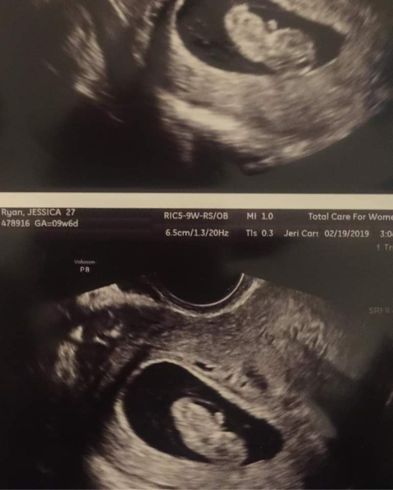 sammystreet51's tweet photo. We got our first glimpse of my newest grandbaby and we got to hear he or she's heartbeat 💞 so far so good 🙏 
#9wks6days
#DueInSeptember 👣💕😍 https://t.co/1EVlbFhaUu
