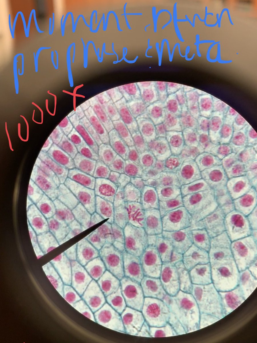deadeucalyptus's tweet photo. More pics of mitosis stages! #bio120sp19 @NutmegSomething https://t.co/7X2KNcrJgA