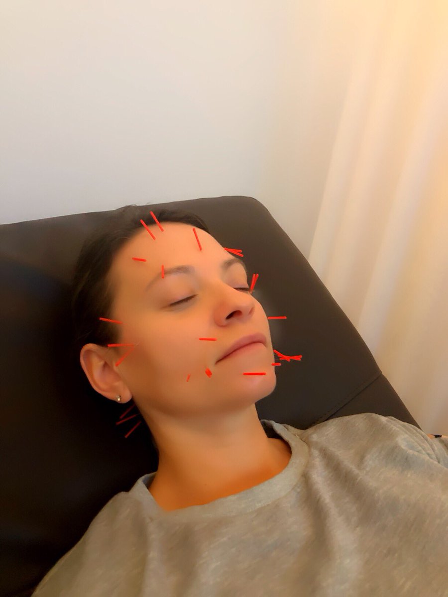 innerbombshell1's tweet photo. Have you tried Cosmetic Acupuncture? Read all about it on our blog @ InnerBombshell #modernacupuncture @ma_modernacupuncture #acupuncture #cosmeticacupuncture #cosmeticacupunture #cosmeticacu #skincare #nontoxic #wellness #face #skin #toxins #wrinkles #complexion #beauty https://t.co/S8DLBqtAy2