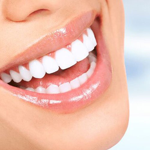 Gülüş Tasarımı Nedir? Nasıl Yapılır? dentoran.com/gulus-tasarimi…
