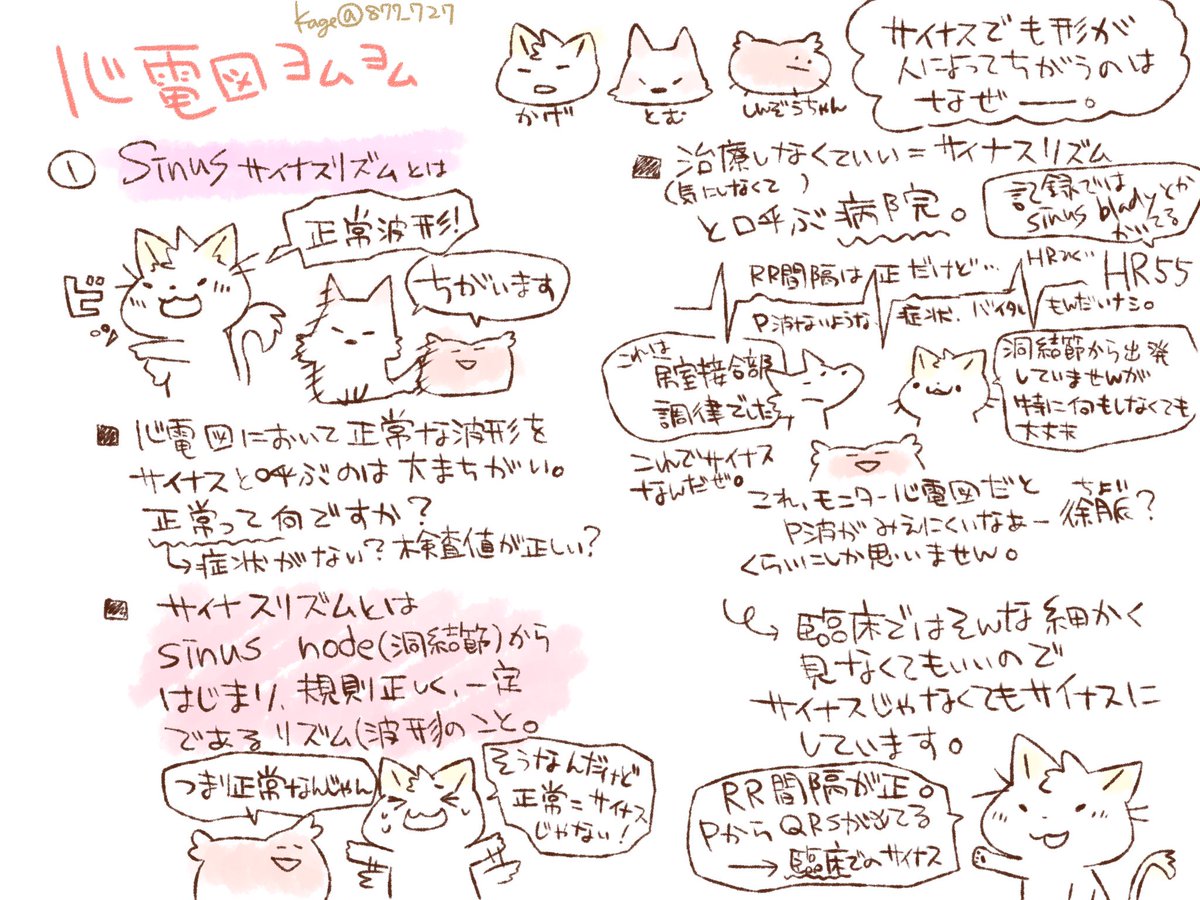 看護師のかげさん イラスト看護帖書籍化 Pa Twitter 心電図ヨムヨム講座 P波見えないのにsrにしてるのなんでだ と思ったら房室接合部調律だったり Pvc出まくりもはやvt の割にゆっくりだしバイタル保たれていたらaivrだったなど たまにあるナニコレが出るの