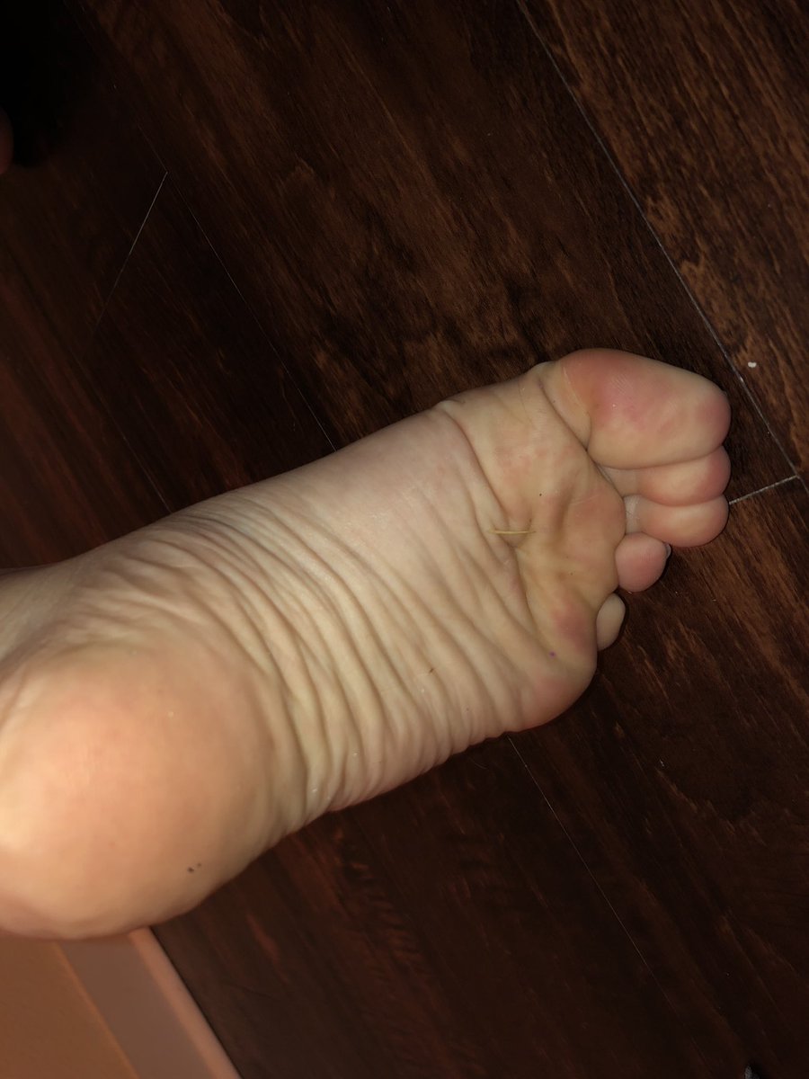 jujusfeet's tweet photo. Wrinkly dirty feet 
#feet #FootFetish #findom #payme https://t.co/5KLp16hf77