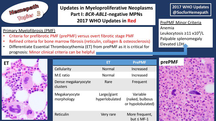 WHO 2017 updates on BCR-ABL1-negative Myeloproliferative Neoplasms: New molecular associations (CSF3R, CALR) and further emphasis on the importance of bone marrow morphologic findings and clinical criteria for accurate #MPN diagnosis #hemepath