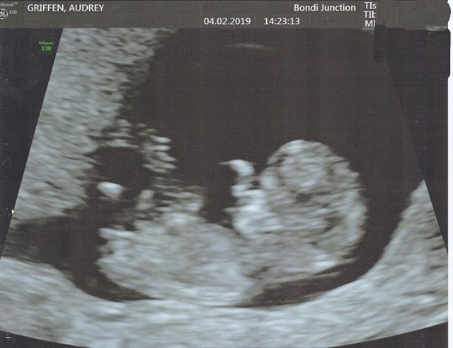 Osher Günsberg tweet media