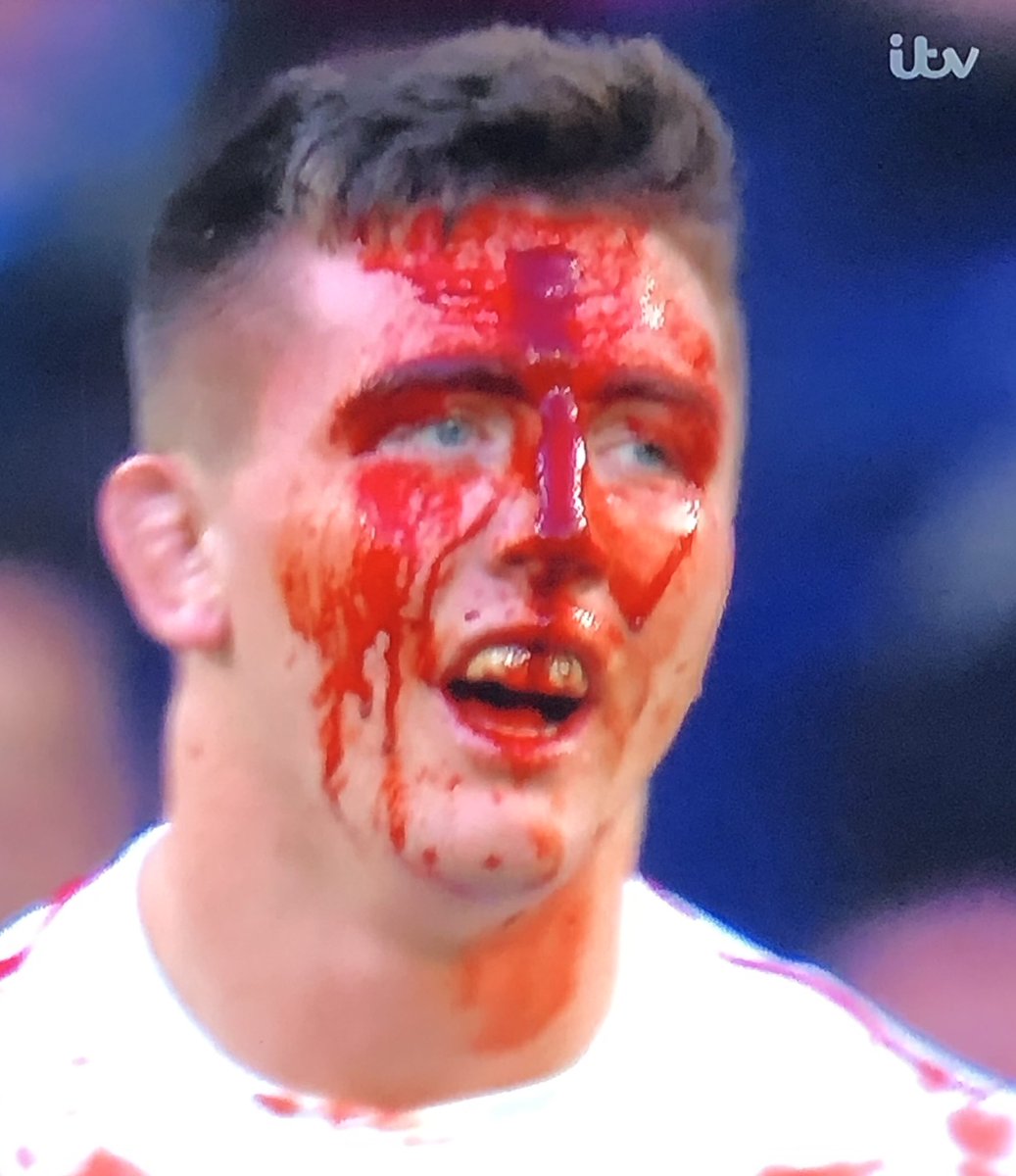 Might want to take a look at that