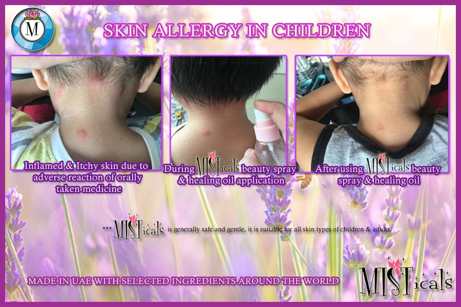 SprayMis's tweet photo. Skin Problem? Looking for Ayurvedic, Botanical, Organic and Natural way of Skin Healing the Miracles of #Misticals 💦🌿🌹Suitable for all ages and all skin types 👌👌👌

Experience Healing. Experience MISTicals @SprayMis #Trending #Beauty #Twitter https://t.co/gu04CJ2bWl