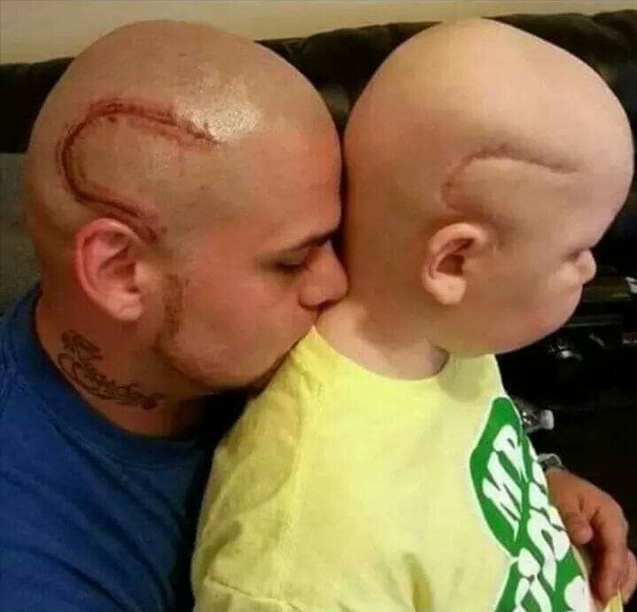 #MASSIVERESPECT 
Dad #Tattoes Son's #Cancer Scar So That His Son Doesn't Feel any  Difference