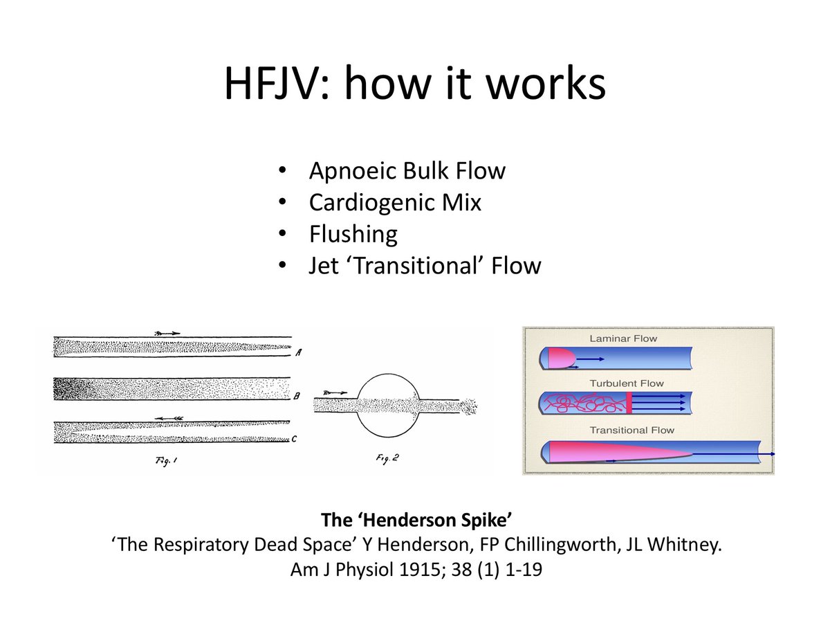 jet_vent's tweet photo. HFJV occurs in an ‘open airway’, so all of the following apply:

1. Apnoeic ‘bulk flow’ 
2. Cardiogenic oscillatory mixing of tracheal-pharyngeal gas
3. Flushing of tracheal gas (by JV)
4. Transitional Jet flow https://t.co/mIofEeJNgh