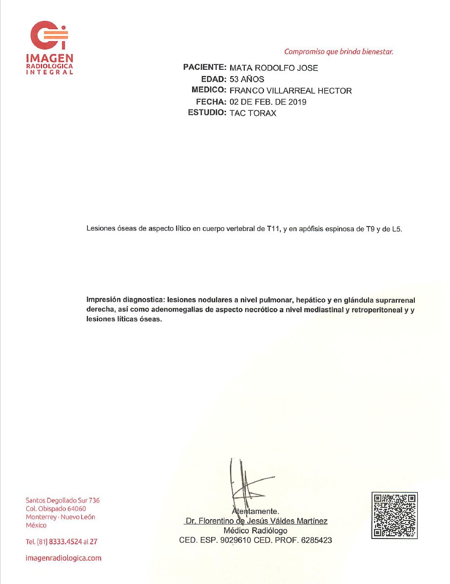 Tengo noticias. La buena es que mi papá entró en el protocolo a mitad de noviembre y le han dado los ciclos de inmunoterapia mensualmente. La mala noticia es que según los estudios más recientes la enfermedad no ha parado de avanzar, tiene metástasis en varias partes de su cuerpo