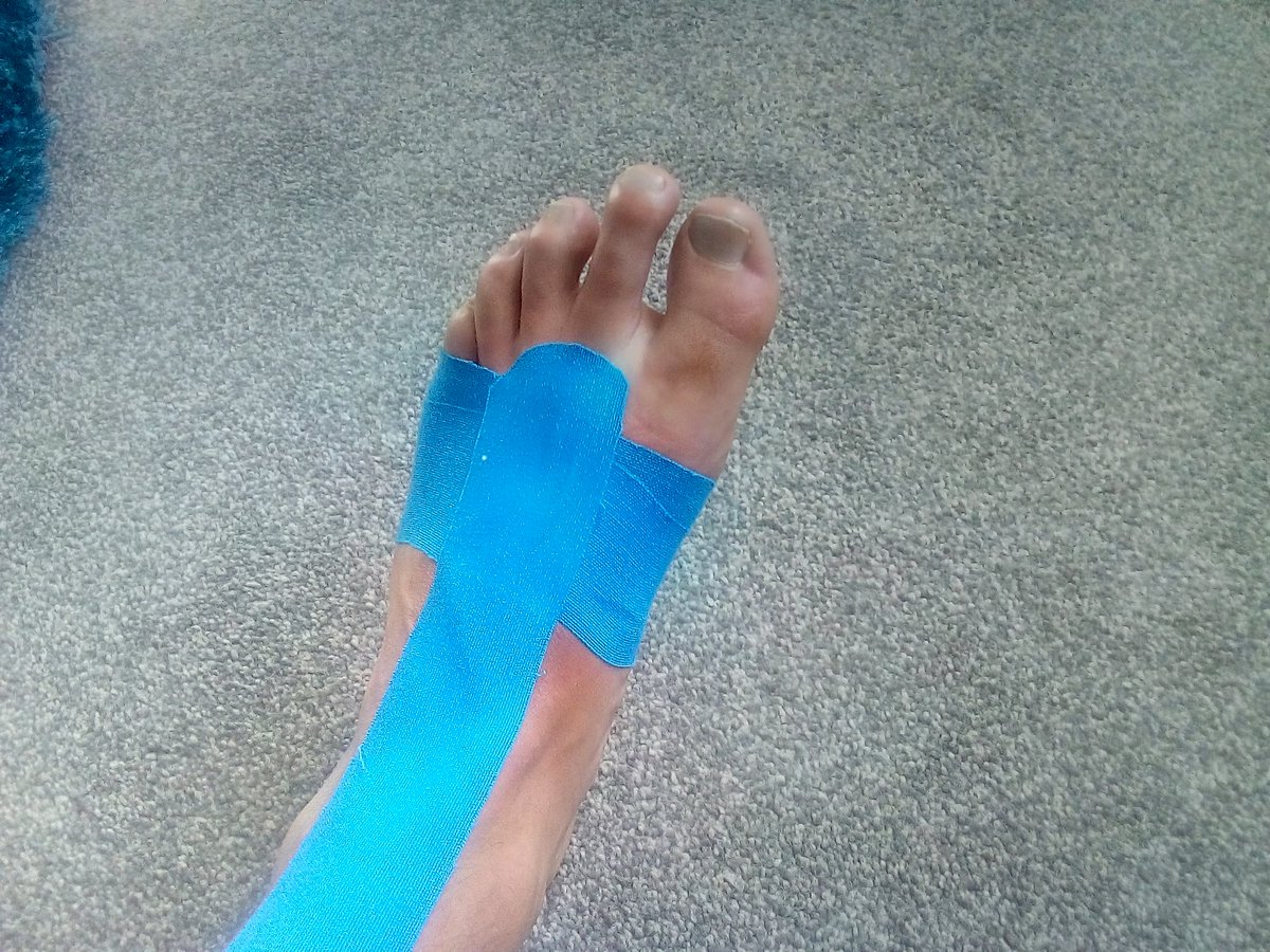 DavieGee4's tweet image. Oouch it's back with avengence..extensor tendonitis #painfull training put on hold again.. happening to regular... #cyclinglifestyle changed all lacing on my footwear..#painrelief #antiinflammatory @microtech_group @VattenfallUK @NHSaaa @PublicHealthAAA