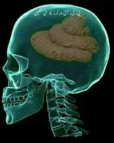 Muhamma37838152's tweet photo. یہ سٹی سکین سچ ھے یا جھوٹ https://t.co/iO1do7mQ5z