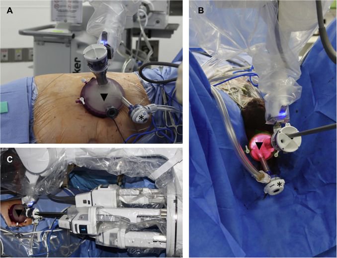 EUplatinum's tweet photo. First clinical investigation regarding surgical procedures performed by using the Da Vinci SP® robotic surgical platform https://t.co/SULJZca3pu https://t.co/tHRb8nstfO