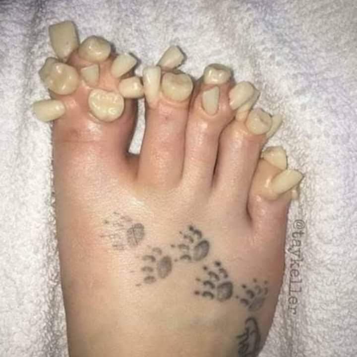 okseunome's tweet image. Se você não der RT, seu pé vai ficar igual o meu. O meu ficou assim depois que eu não dei rt na postagem. Me arrependo até hoje de não ter dado RT ao maldito post!
Obs: eu não estou brincando.