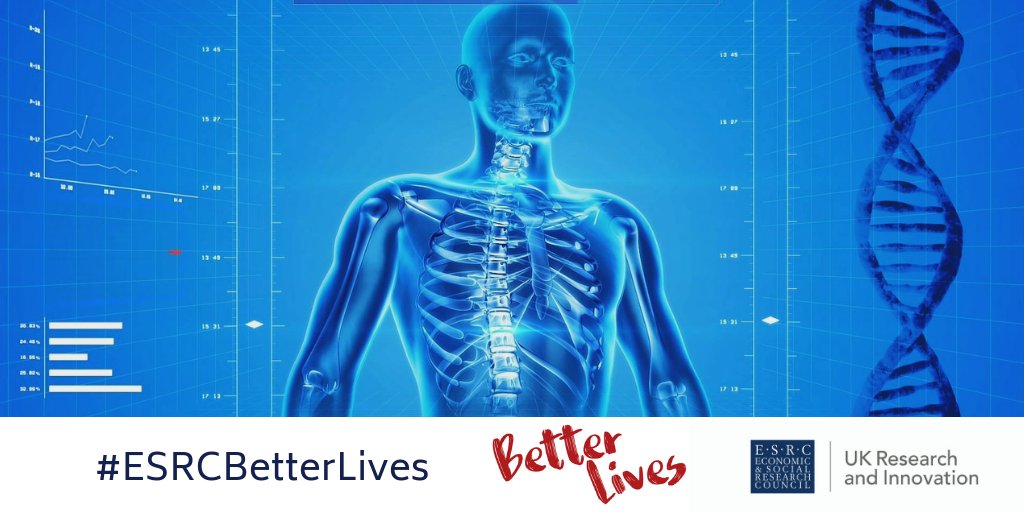 ESRC's tweet image. Multiple chronic conditions: an emerging healthcare challenge: bit.ly/2UTJNNz  

Over the next 20 years the number of people with two or more chronic conditions will almost double to nearly 10 million. 

#ESRCBetterLives #ThisIsSocialScience @MODEMproject @OfficialNIHR