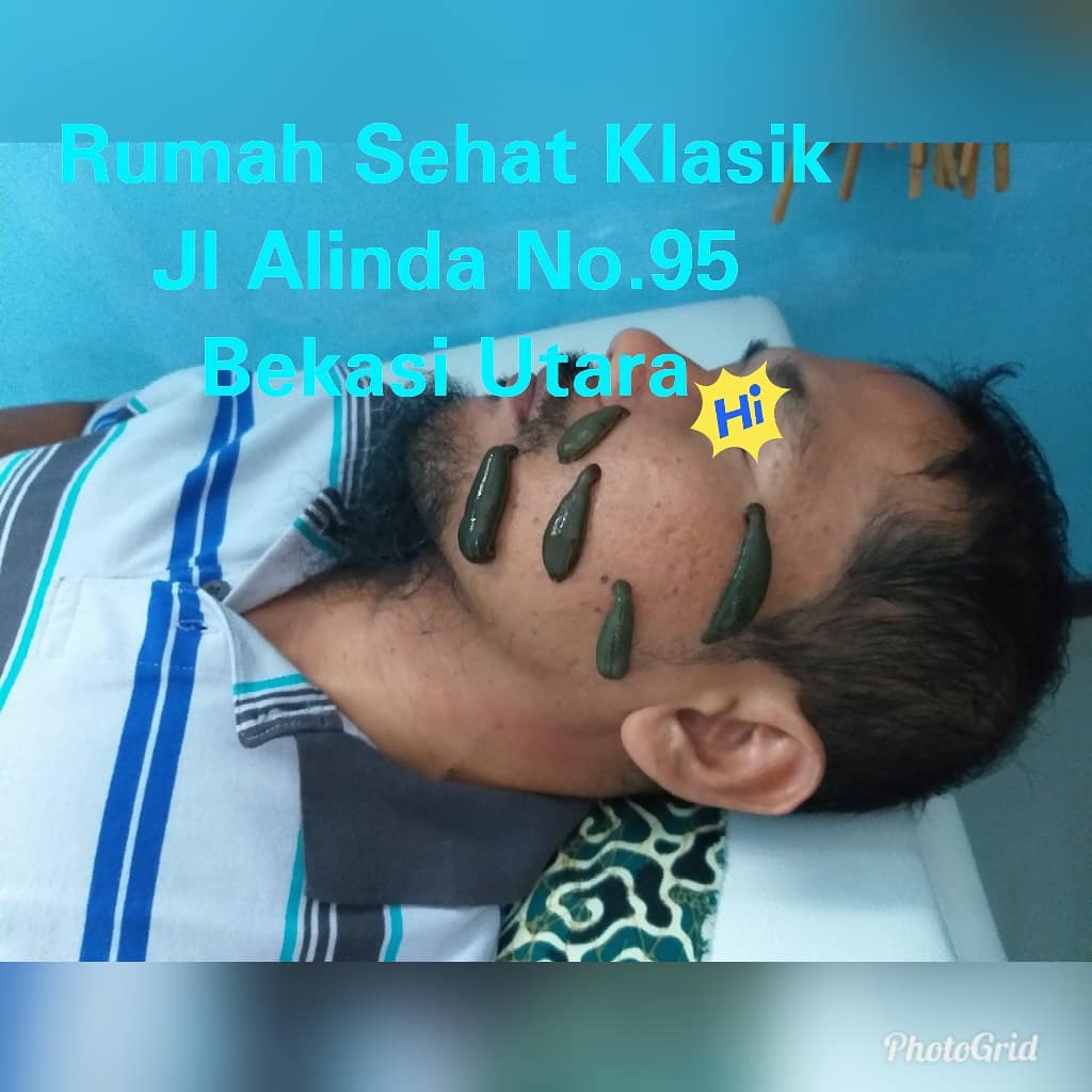 RumahSHT_Klasik's tweet photo. Alhimyah lebihutama Ad-dawa (menjaga polahidup lebih utama daripada obat)&amp;Nasihat lebih berharga dr obat
Health and wealth with RS Klasik Jl Alinda No.95 Bekasi Utara. 
Come and feell the difference 🏥
#bekasiutara 
#sehat 
#backtonature 
#health
#wealthmanagement
#thibbunNabawi https://t.co/ZjEHO9iZkb