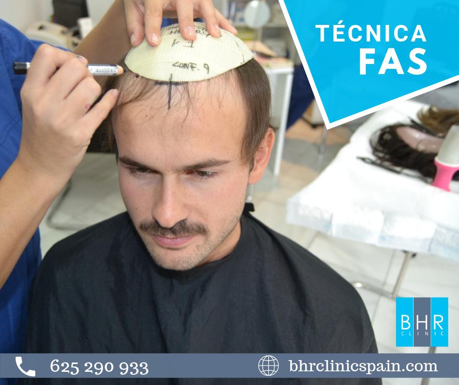 MeyeryAlcaide's tweet photo. 🗣 Personalizamos nuestras prótesis 🗣
✔ Toma de medidas para diseñar prótesis capilar a medida.
Con la técnica FAS tomamos medidas a cada paciente para lograr el mejor resultado 🔝
.
.
.
#Alopecia
#ProtesisCapilar
#TecnicaFAS
#Dermatologos
#Capilar https://t.co/xN14aI7iyp