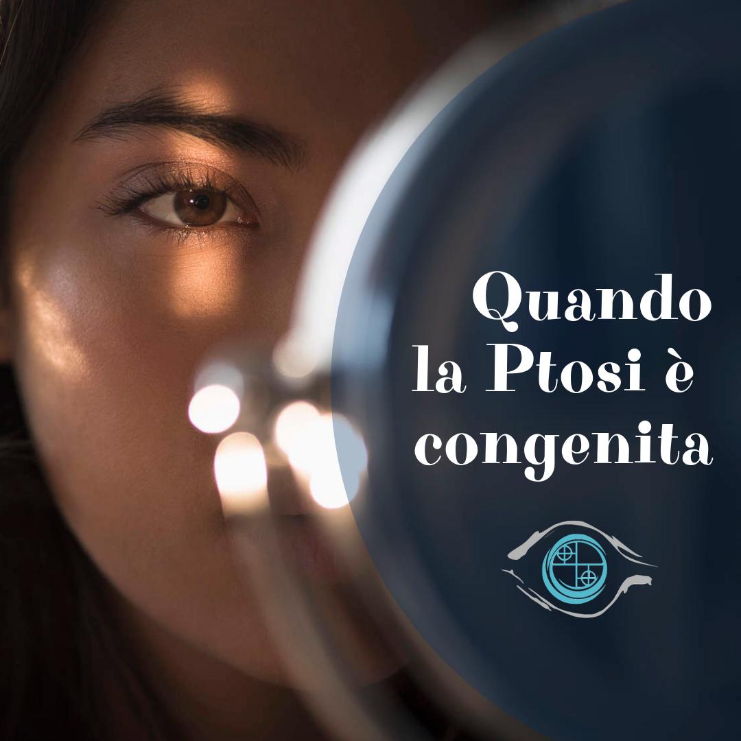 La ptosi congenita non ha cause precise, ma è legata ad una distrofia congenita localizzata al muscolo elevatore della palpebra superiore.

🖇️ oculoplasticabernardini.it/4879-ptosi-pal…
✨

#ptosicongenita #ptosipalpebrale #bambinio #ptosibambino #palpebra #palpebraabbassata