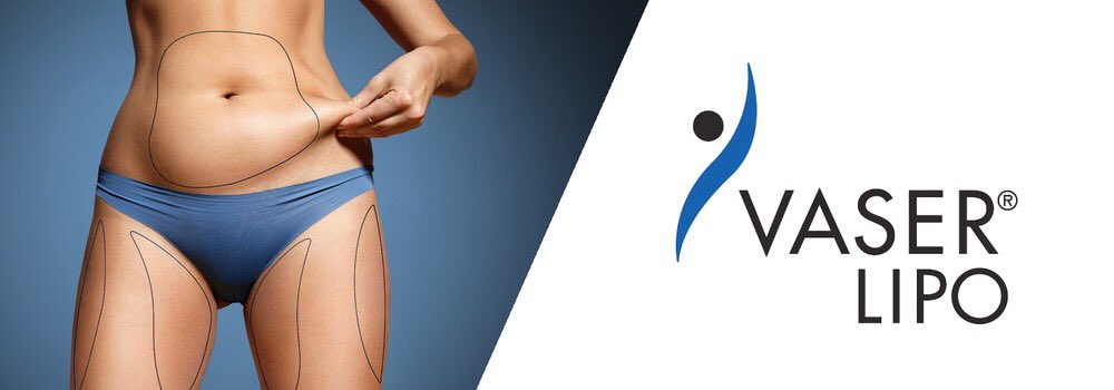 DrAshishDutta's tweet photo. Because of the potency of the equipment and the delicacy of the instruments, I can now undertake ´#MicroLiposuction´ at the @AestheticBC; on sensitive areas such as the #Face, #Neck, #Arms and #Thighs. This can be undertaken within a day and no #Downtime.
https://t.co/KFhh3MwmmJ https://t.co/yu8hGSeRze