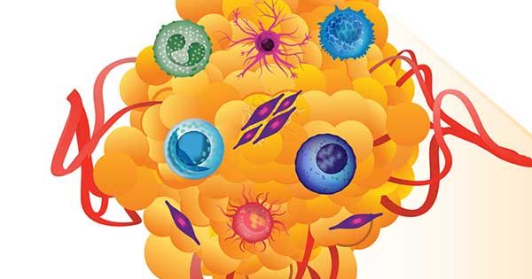 theNCI's tweet photo. The Human Tumor Atlas Network initiative will create maps of human tumors, including their surrounding environments: https://t.co/jhV0FeqOdN #cancercurrents @NCIHTAN https://t.co/dU2UdTV3yg