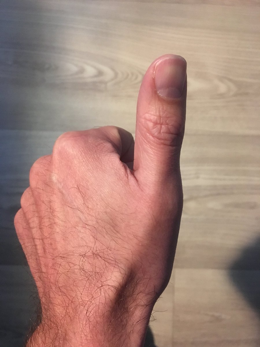 Aujourd’hui je relève le défi de poster la photo de mes doigts. 1 par jour pendant 11 jours, pas de commentaire, juste une photo.
Jour 1