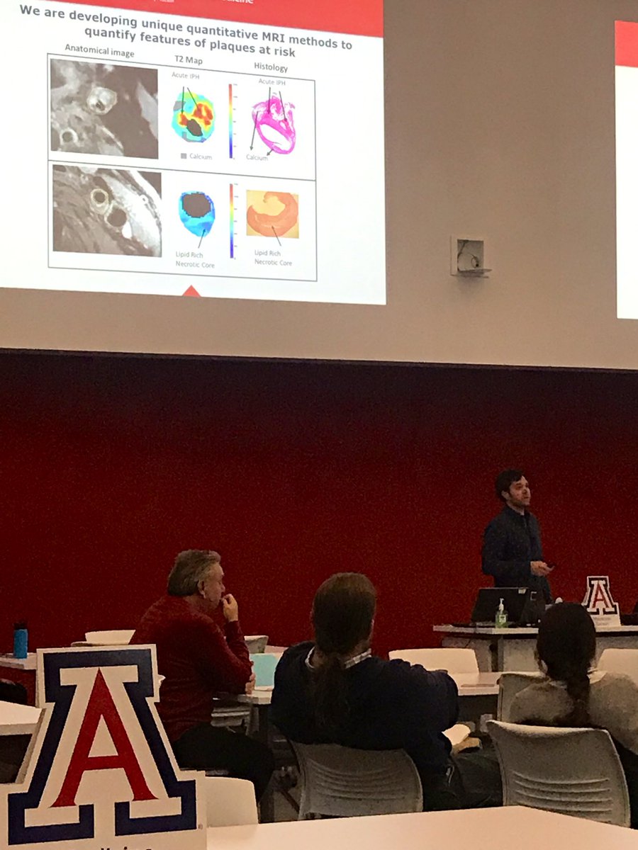UofAZSurgery's tweet image. Dr. Craig Weinkauf discussing new techniques to identify plaques at risk in carotid atherosclerotic disease. #COMReserachDay2019 #Datablitz