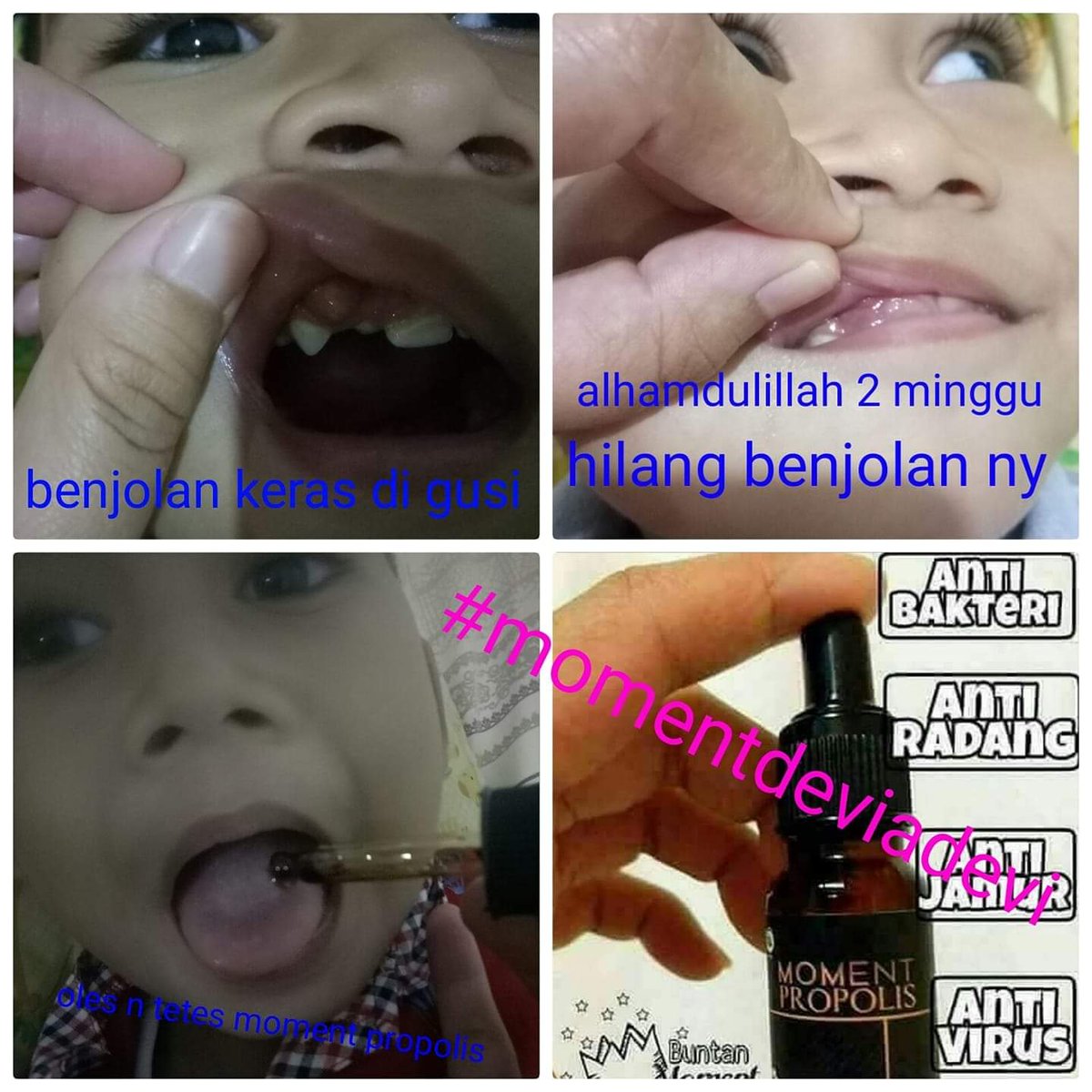 dianastuti86's tweet photo. Real testimoni dari adalah satu member Moment mbk Eka 😇

Keluhan / sakit
Benjolan keras di gusi
Produk moment yg di gunakan
Moment Propolis ...

Info lebih lanjut 👇
Sms/Tlp/ wa 081288514757 https://t.co/9iEQU7KaGz