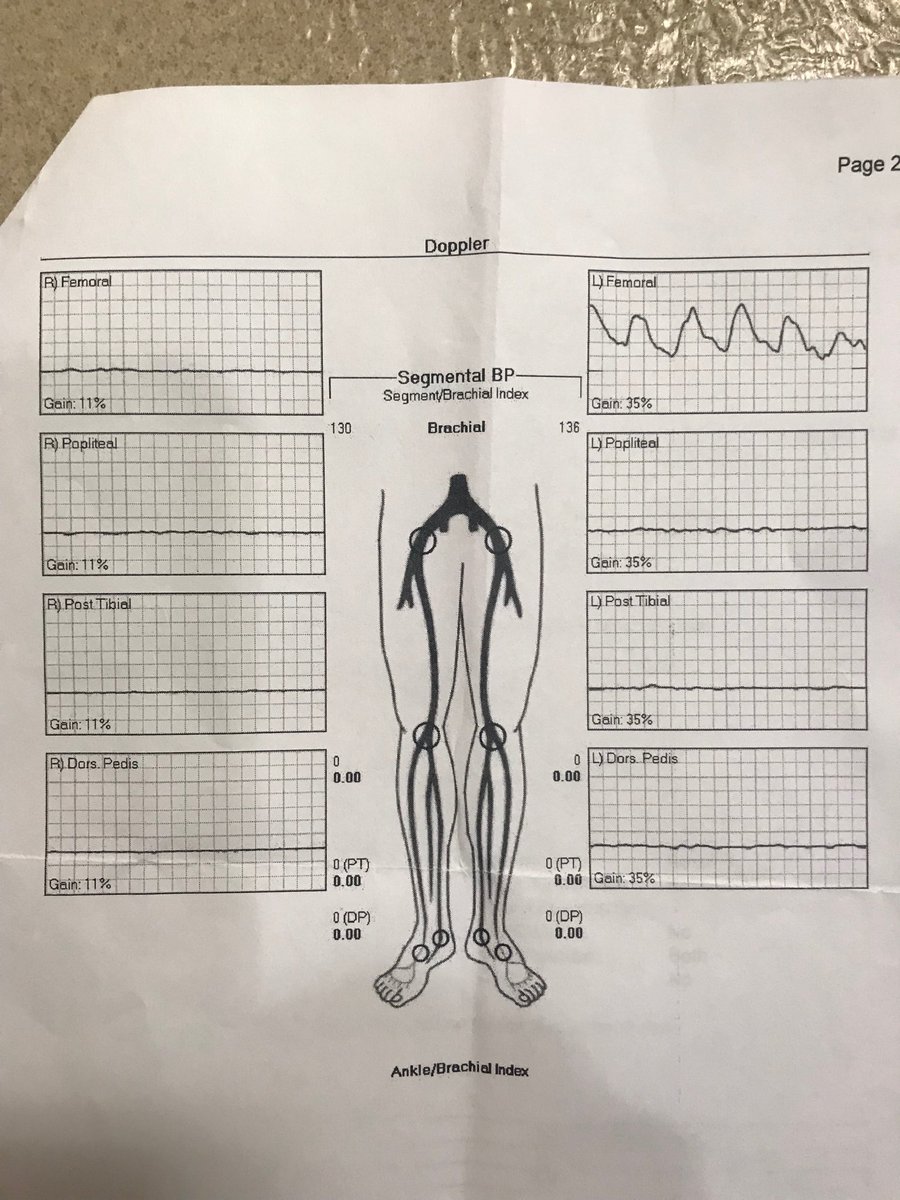 You know you're in for a fun night when this comes to you from the ED. #clifighter #irad