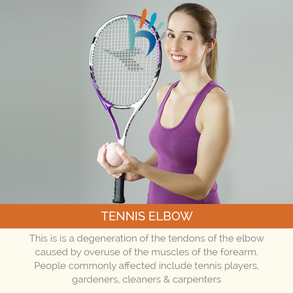 Have you ever heard of Lateral Epicondylitis? #handtherapy #tips #health #physio #loveyourhands #handtherapist #physiotherapy #hand #physicaltherapy #therapy #handpain