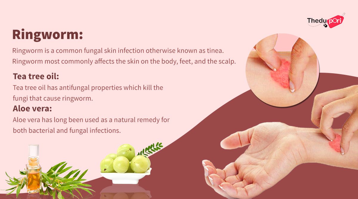 Natural Remedy For Ringworm.
Website: bit.ly/Sringworm
Contact: 9025195336
#ringworm #skindiseases #skincare #teatreeoil #amlapowder #neylikaipowder #thedupori #seo #smo #onlineshoppingsite #herbalproducts #product #ayurvedic #ayurvedicmedicine #naturalproduct #homeremedy