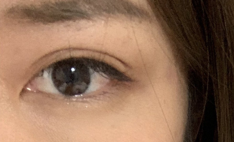 顔がおかめ 今年二重プチ整形することを決めました 私みたいな目頭ぎゅいん食い込みタイプはどんなのが合うんだろう と ひとりシュミレーション 目が1番大きく見える位置で って言うつもり もういっそのこと切るのもありだけど勇気出ず 10年間